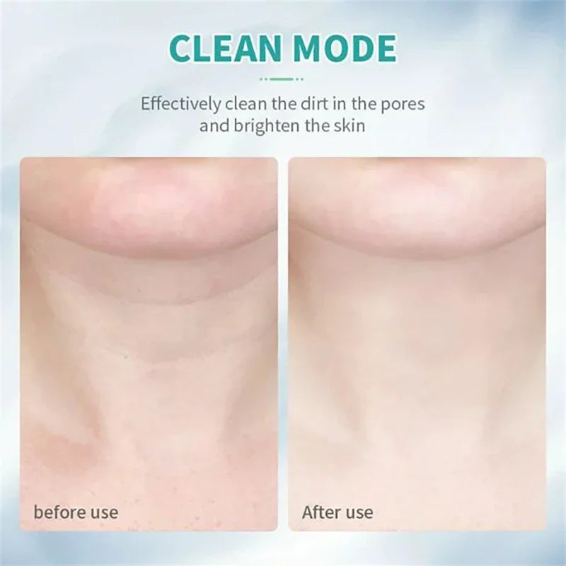 7-Mode Face & Neck Lifting Massager – Skin Tightening Beauty Device